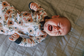 Baby Eczema: Causes and Ways to Find Relief